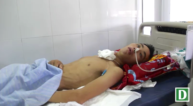 Bố bỏ đi, mẹ tâm thần, cậu học sinh chăm anh trai tai nạn nguy kịch trong khốn khó - 5 Anh trai Pháp là Bùi Hữu Đức bị tai nạn đang nằm điều trị tại BVHNĐK Nghệ An.