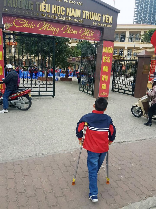 Vụ học sinh trường tiểu học Nam Trung Yên gãy chân: Đã có kết quả giám định thương tật - 1 Cháu Trần Chí Kiên đã trở lại trường. (Ảnh do gia đình cháu Kiên cung cấp)