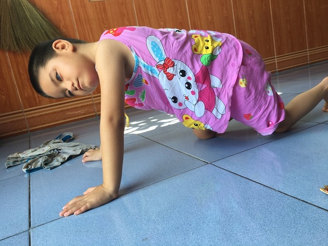 Số phận éo le của cô bé bị tim, câm điếc bẩm sinh, hỏng hai mắt - 1 Số phận éo le của cô bé bị tim, câm điếc bẩm sinh, hỏng hai mắt - 1