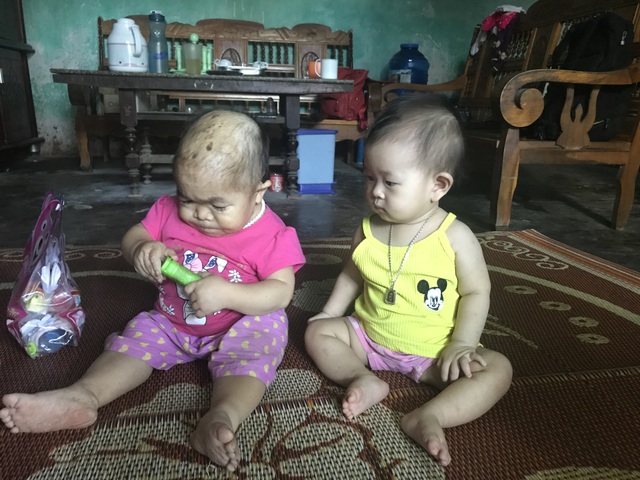 Kỳ lạ người phụ nữ 27 tuổi mang hình hài "trẻ lên 2" ở Thái Nguyên - 1 Dù đã 27 tuổi những chị Dung chỉ trông như một đứa trẻ lên 2. Trong ảnh là Dung với người cháu ruột năm nay 9 tháng tuổi. Ảnh: Minh Anh