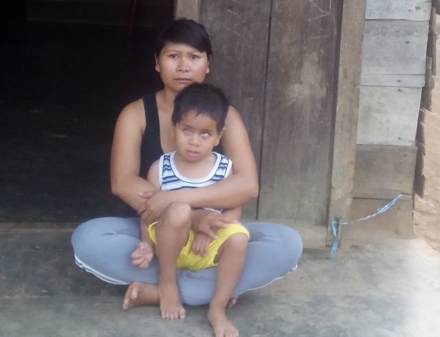 Bé 4 tuổi nguy kịch vì u nguyên bào võng mạc - 7 Chị H Đuy chỉ mong giữ được mạng sống cho con mình...