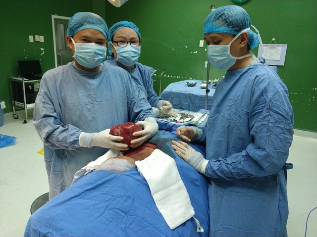 Cắt thành công khối u to như quả bưởi nằm trên cổ - 2 Các bác sĩ phẫu thuật lấy khối u nặng 2kg ra khỏi người bệnh nhân