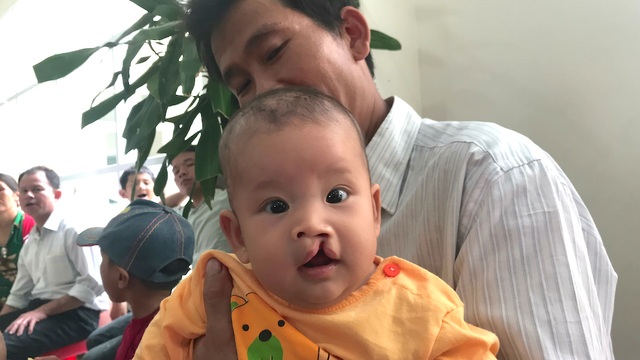 “Thế là từ nay con tôi sẽ có nụ cười tươi rồi” - 2 Những đứa trẻ bị hở hàm ếch nặng trong đợt này sẽ được Tổ chức Operation Smile và nhà tài trợ Sika, bệnh viện quốc tế Vinh mổ miễn phí.