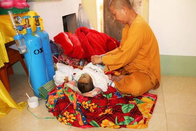 Nhói lòng bé 10 tháng tuổi bị teo mật bẩm sinh - 4 Mắc chứng bệnh tắc đường mật bẩm sinh, bé Khôi ốm yếu, da vàng như váng nghệ. Suốt ngày bé chỉ khóc vì bệnh tật.