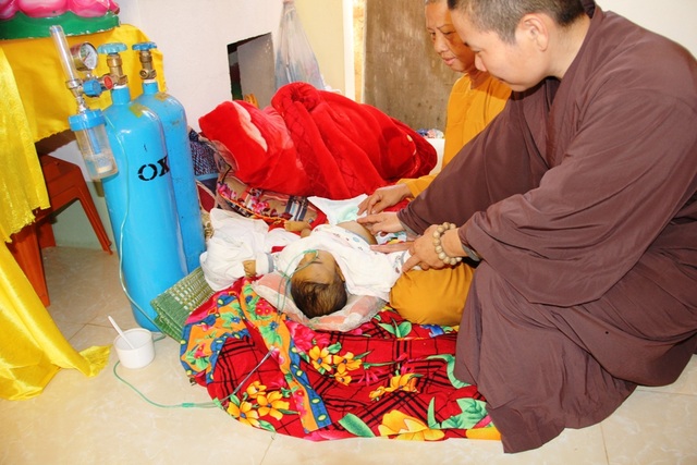 Nhói lòng bé 10 tháng tuổi bị teo mật bẩm sinh - 3 Cháu đã được nương nhờ cửa chùa gần 1 tháng qua. Cũng vì mang bệnh nên biểu hiện rất rõ chứng bệnh tắc đường mật trên thân thể bé Khôi nhỏ bé so với 10 tháng tuổi.