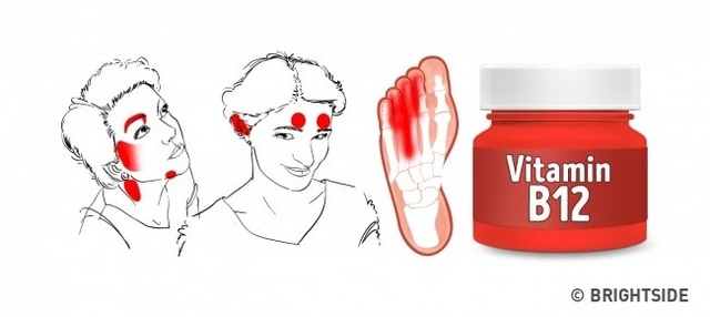 Những dấu hiệu cho thấy cơ thể thiếu vitamin - 6 Những dấu hiệu cho thấy cơ thể thiếu vitamin - 6