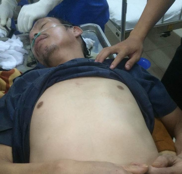 Công an thông tin về vụ người đàn ông nhập viện sau 1 ngày bị tạm giam - 1
Anh Vũ Văn Chiến nhập viện sau 1 ngày bị tạm giam