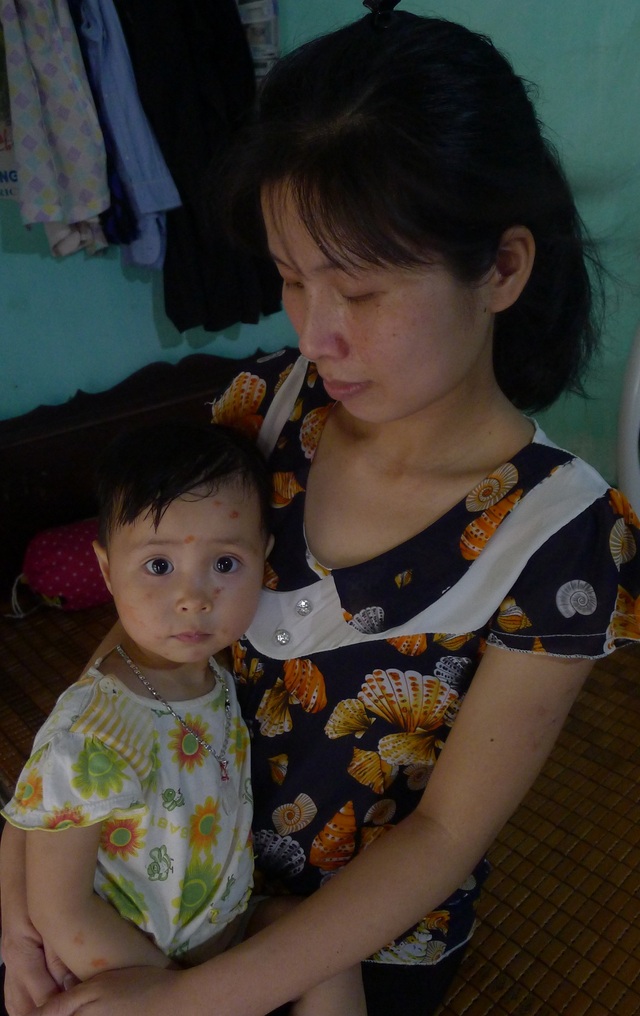 Thương bé 9 tuổi nguy kịch vì bệnh ung thư máu - 3 Ở nhà chị còn đang chăm bé thứ 2 là Nguyễn Hồng Ngọc (3 tuổi) đang bị thủy đậu.