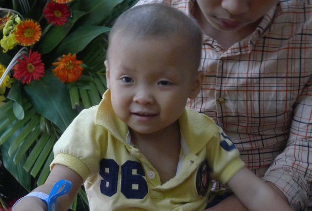 Gần 28 triệu đồng tiếp tục đến với hai chị em cô bé Linh bị ung thư thận - 3 Hiện cô bé Linh phải xạ trị thường xuyên để duy trì sự sống.