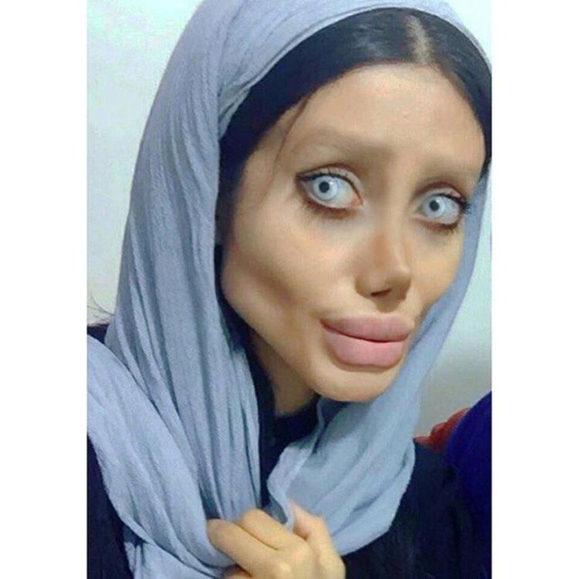 Giật mình ngắm Angelina Jolie phiên bản "zombie" ngoài đời thực - 2 …nhưng trải qua 50 cuộc phẫu thuật, Sahar vẫn chỉ được đánh giá là phiên bản lỗi