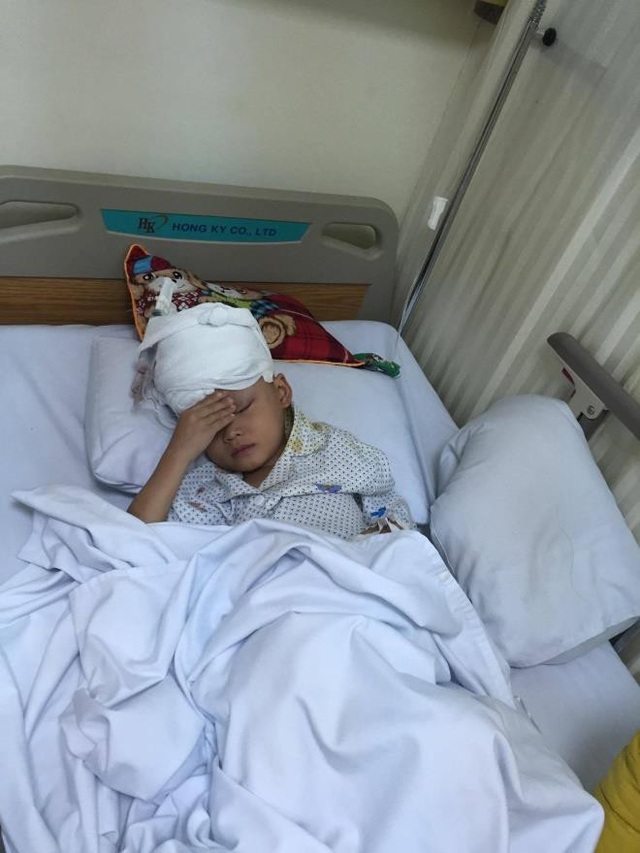 Bệnh viện Hà Thành phẫu thuật miễn phí cho bé bị u hắc tố bẩm sinh diện rộng - 3 Hạo Nhiên sau khu thực hiện ca phẫu thuật
