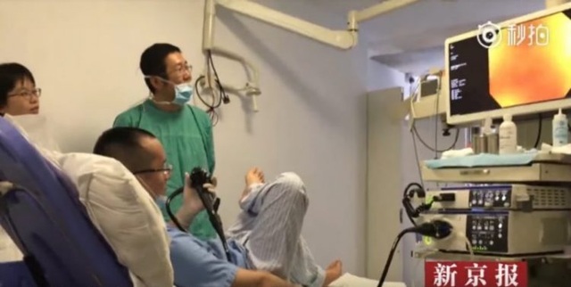Bác sĩ tự nội soi đại tràng chính mình để hiểu nỗi đau của bệnh nhân - 2 Bác sĩ tự nội soi đại tràng chính mình để hiểu nỗi đau của bệnh nhân - 2