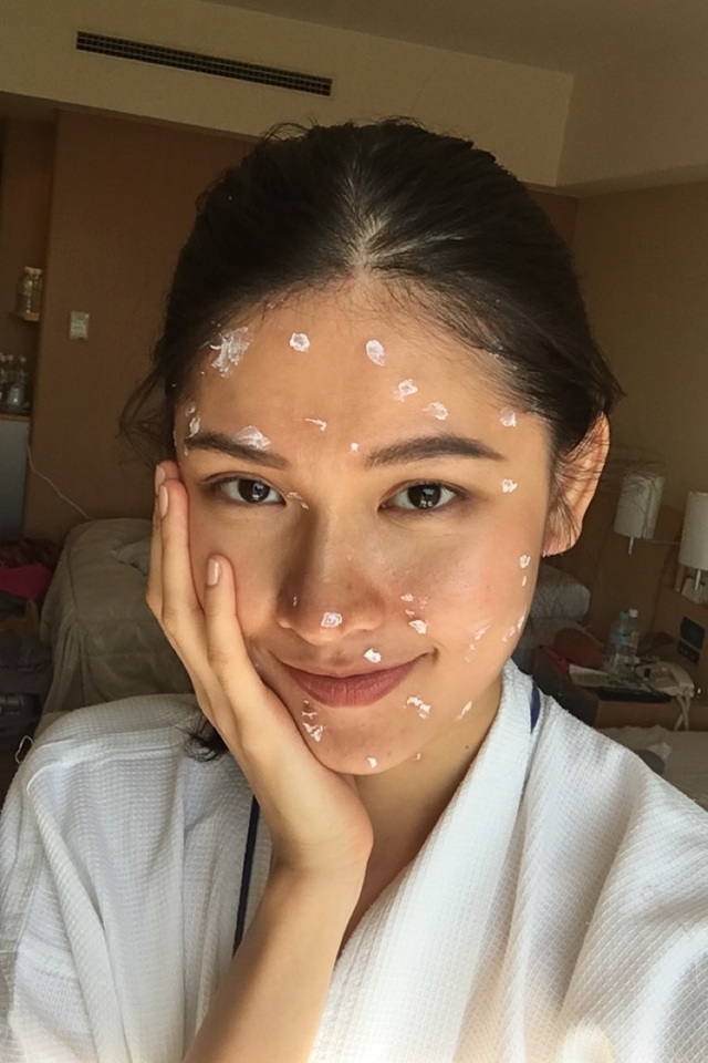 Lọt Top 15 của Missosology nhưng Thùy Dung bị thuỷ đậu, chảy máu mũi trước chung kết - 5 Tuy nhiên, từ Tokyo, Thùy Dung cho biết, cô có dấu hiệu bị bệnh thuỷ đậu với loạt triệu chứng: sốt cao, nổi mẩn đỏ khắp người...