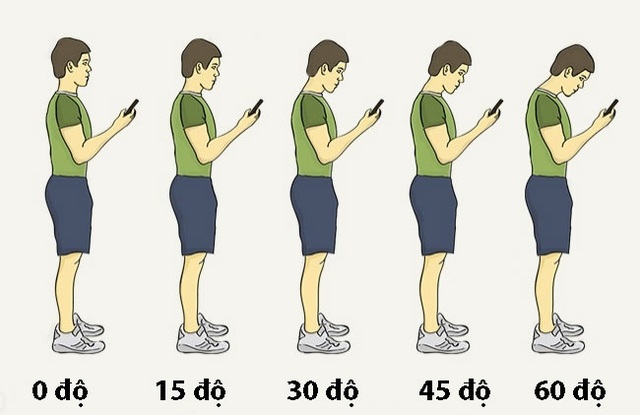 9 cách thông minh để lưng thẳng và đẹp - 3 9 cách thông minh để lưng thẳng và đẹp - 3