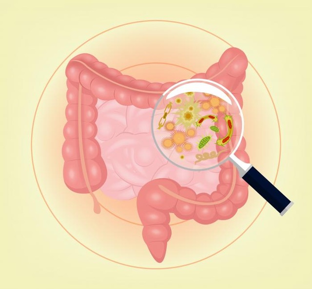 Kháng sinh có thể làm tăng nguy cơ ung thư ruột ở phụ nữ - 1 Nghiên cứu mới chỉ ra mối liên quan giữa kháng sinh, hệ vi khuẩn ruột, và nguy cơ ung thư ruột.