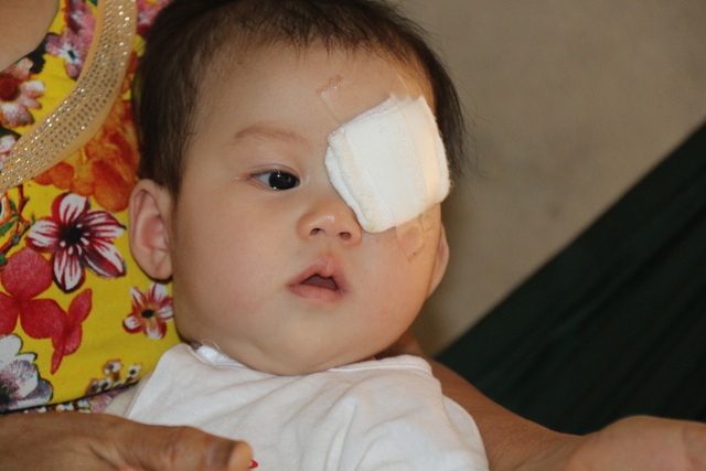 Hơn 3 tháng tuổi, Quỳnh Chi đã phải giành giật sự sống trước căn bệnh ung thư võng mạc