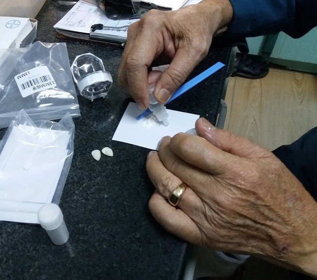 Mua răng... trên mạng, trào lưu làm đẹp nguy hiểm của giới trẻ - 3 BS.CKII Trần Ngọc Đỉnh kiểm tra nguyên liệu gắn răng khểnh giả