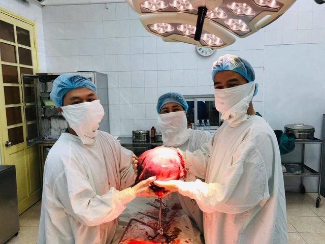 Người phụ nữ phải cắt tử cung vì khối u có trọng lượng lớn hơn một thai nhi 9 tháng tuổi - 1 Người phụ nữ phải cắt tử cung vì khối u có trọng lượng lớn hơn một thai nhi 9 tháng tuổi - 1