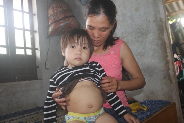 Thương bé gái 4 tuổi có nguy cơ bị bại liệt - 9 Vợ chồng anh Linh mong một phép màu để cứu sống con.