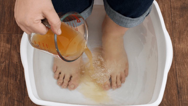 Những lợi ích khi ngâm chân trong giấm - 1 Những lợi ích khi ngâm chân trong giấm - 1