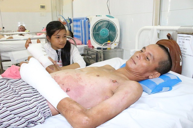 Cha nguy kịch vì bỏng điện, bầy con thơ đói khát - 3 Phải nghỉ học vì nhà nghèo, bé Thúy Hằng lại thêm sốc khi tai nạn ập đến với cha