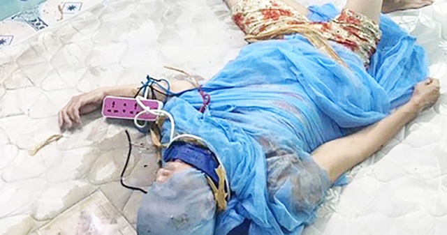 Con đóng đinh vào đầu mẹ để chữa bệnh vì "đạo vô vi" - 1 Bà Trương bị con trai đóng đinh vào đầu vì tin theo đạo lạ