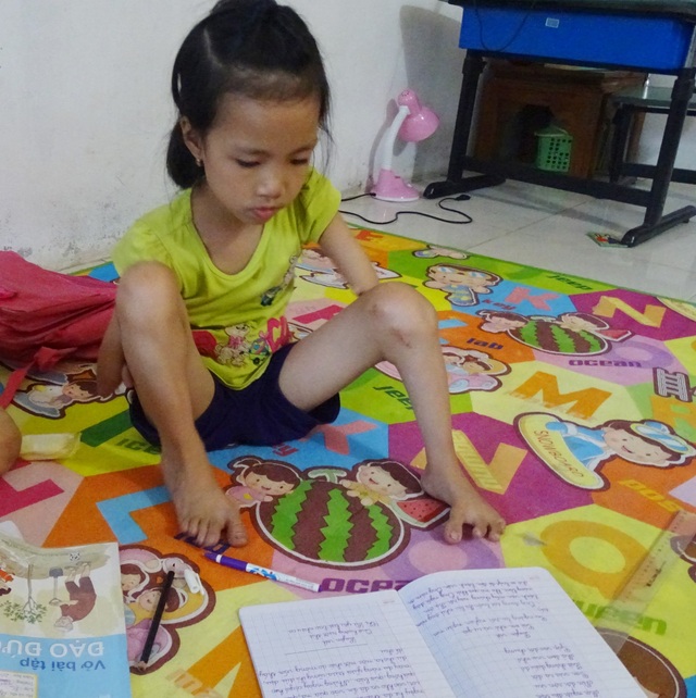 Cô bé 9 tuổi cụt hai tay, viết chữ đẹp như máy khiến bao người cảm phục - 2 Con bị cụt hai tay, một chân bị khoèo, thiếu ngón.