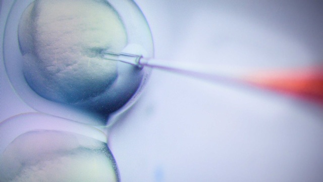 WHO sẽ thành lập ủy ban nghiên cứu việc chỉnh sửa gen - 1
Phương pháp chỉnh sửa gen CRISPR/Cas9 tại trung tâm Max-Delbrueck. Ảnh: Global Look Press.