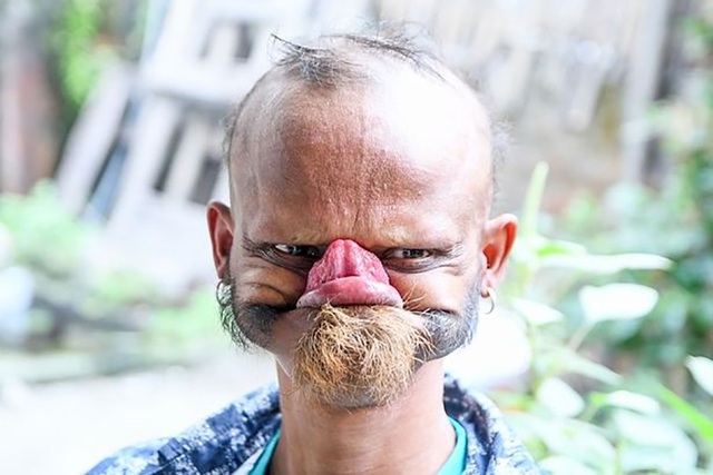 Kì lạ người đàn ông có lưỡi “siêu dài” - 2 Với khả năng dùng lưỡi… liếm trán, Yagya Bahadur Katuwal khiến trẻ em sợ hãi.