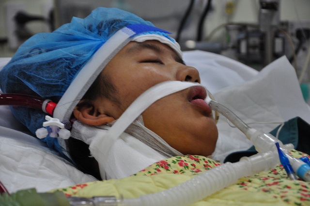 Không có tiền lọc máu, bố xin cho con về để được chết ở nhà - 2 Tại khoa Hồi sức tích cực em đã được đặt ống nội khí quản, lọc máu, sử dụng máy tim phổi nhân tạo.