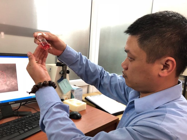 Bác sĩ kể về giây phút cô bé thiên thần 7 tuổi hiến giác mạc khi qua đời - 2 Anh Hoàng nâng niu khi tiến hành kiểm tra chất lượng cặp giác mạc cô bé thiên thần 7 tuổi hiến tặng cho bệnh nhân mù. Ảnh: H.Hải