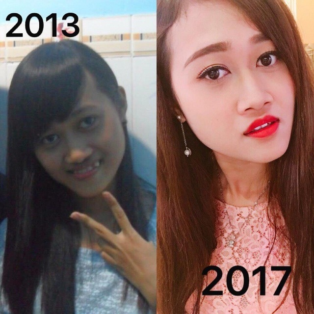 Loạt ảnh bạn trẻ “dậy thì thành công” tiếp tục gây bão mạng - 4 (ảnh: Mêu Hy)