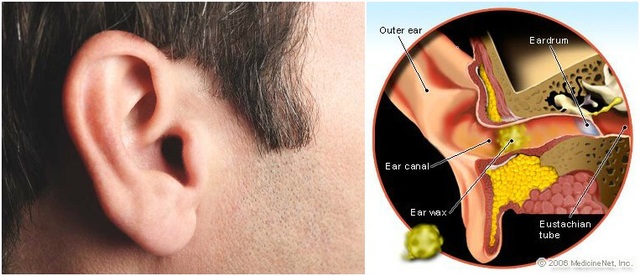 Tại sao cơ thể con người lại sinh ra ráy tai? - 1 Tại sao cơ thể con người lại sinh ra ráy tai? - 1