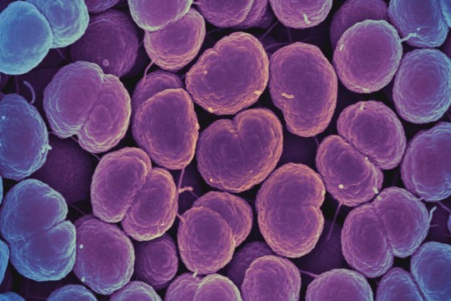 Bệnh lậu không chữa được lan tràn ở Trung Quốc - 1
Lậu cầu Neisseria gonorrhoeae, thủ phạm gây ra bệnh lậu. Ảnh: NIAID / Flickr.