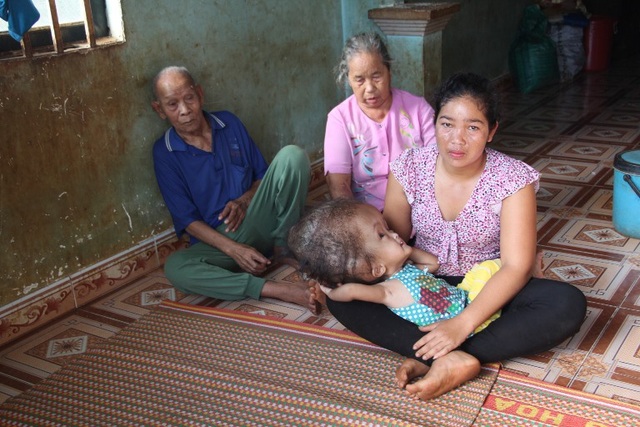 Sự sống mong manh của bé gái Ê đê có chiếc đầu to gấp 4 người bình thường - 3 Chị HMet ngoài việc chăm con bệnh còn lo cho ông ngoại bị mù