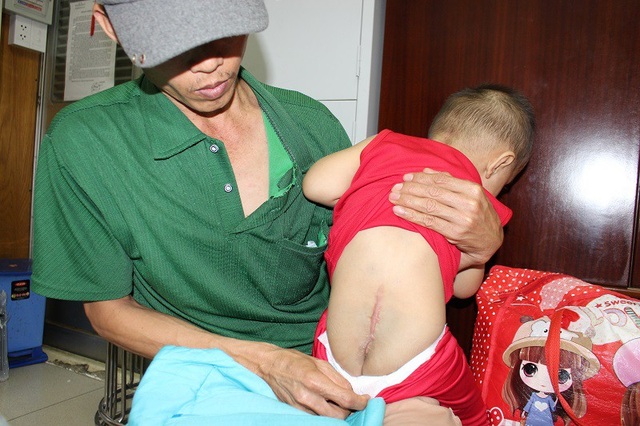 Bé mang trọng bệnh lay lắt theo cha nuôi mẹ đang nguy kịch - 2 Bé mang trọng bệnh lay lắt theo cha nuôi mẹ đang nguy kịch - 2