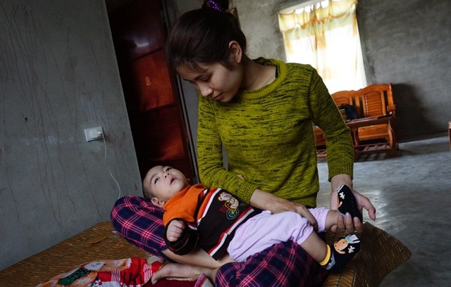 “Trời đã cướp mất của tôi một đứa rồi, xin đừng làm tội đứa còn lại” - 5 Song song với việc điều trị bằng thuốc, chị đang tập vât lí trị liệu để tránh cơ thể con bị co cứng, chờ đợi phép màu của y học để con có thể phát triển bình thường.