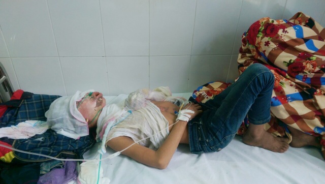 Tẩm xăng đốt con và cháu vì "tội"... tự ý nhuộm tóc đỏ - 1
Một trong hai nạn nhân trong vụ bỏng đang được điều trị tại Trung tâm Y tế Hải Hà. (ảnh: QTV)