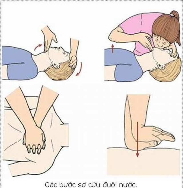 Bé trai đuối nước được cứu sống nhờ cha kiên trì thổi ngạt - 1 Sơ cứu ban đầu rất quan trọng, tăng cơ hội sống cho người bị ngạt nước. Ảnh internet.