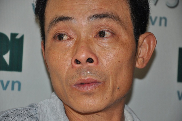 Nghẹn ngào vợ bị tim nặng cầu xin cho chồng ung thư được nhập viện - 1 Anh Thà được phát hiện bị ung thư phế quản nhưng không có tiền nhập viện điều trị.