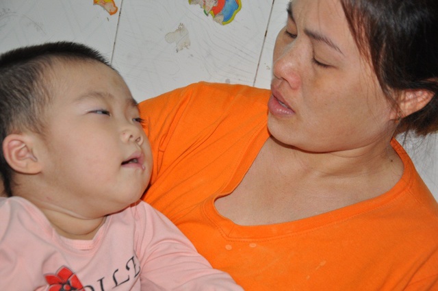 Sặc cháo, bé 3 tuổi bị tổn thương não trầm trọng - 7 Còn không hi vọng cho cô bé này vì bố mẹ không thể vay được tiền điều trị cho em.