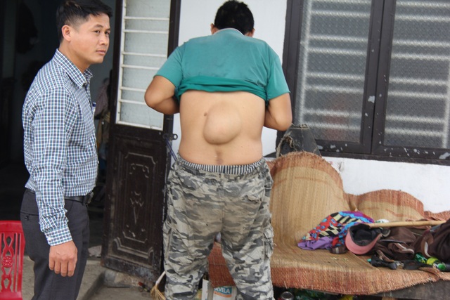 Mẹ bỏ đi, nam sinh lớp 8 chăm bố u não, chị tật nguyền - 6 Mẹ bỏ đi, nam sinh lớp 8 chăm bố u não, chị tật nguyền - 6