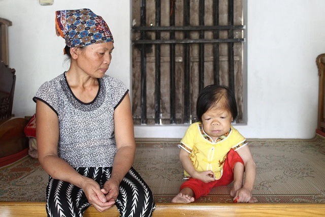 Thanh không nói được câu nào, lúc nào cáu gắt cái gì thì chỉ khóc thôi, không khác gì một đứa trẻ. Thanh không cười nhiều như những đứa trẻ khác nhưng rất tình cảm với mẹ