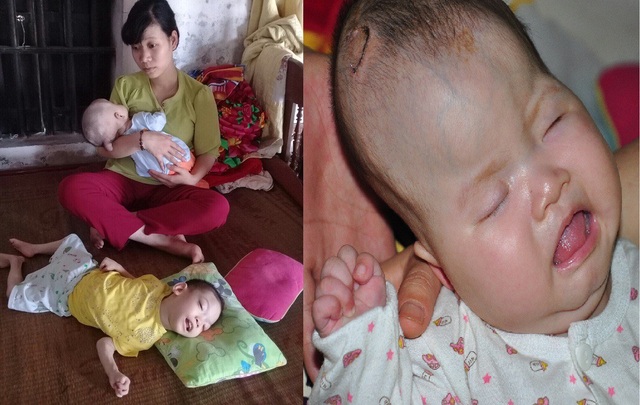 "Giá trời bắt mẹ chết đi, còn hơn sinh ra các con phải khổ như này !" - 10 Hương tâm sự nếu như có thể chết để đánh đổi lấy sự sống cho hai con em cũng cam lòng.