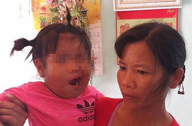 Vụ bé 3 tuổi liệt dây thần kinh số 7 nghi do cô giáo đánh: Công an vào cuộc xác minh - 1 Hiện ngành giáo dục phối hợp với nhà trường, chính quyền địa phương và gia đình đưa cháu đến bệnh viện xác minh kỹ sự việc