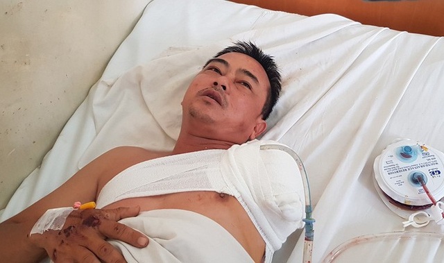 Vụ lật xe trên đèo: Tài xế lao xe vào vách núi để tránh thảm họa rơi xuống vực? - 2
Nam tài xế xe khách cho rằng đã cố gắng đưa xe sang phía núi để tránh thảm họa xe khách rơi xuống vực thẳm.