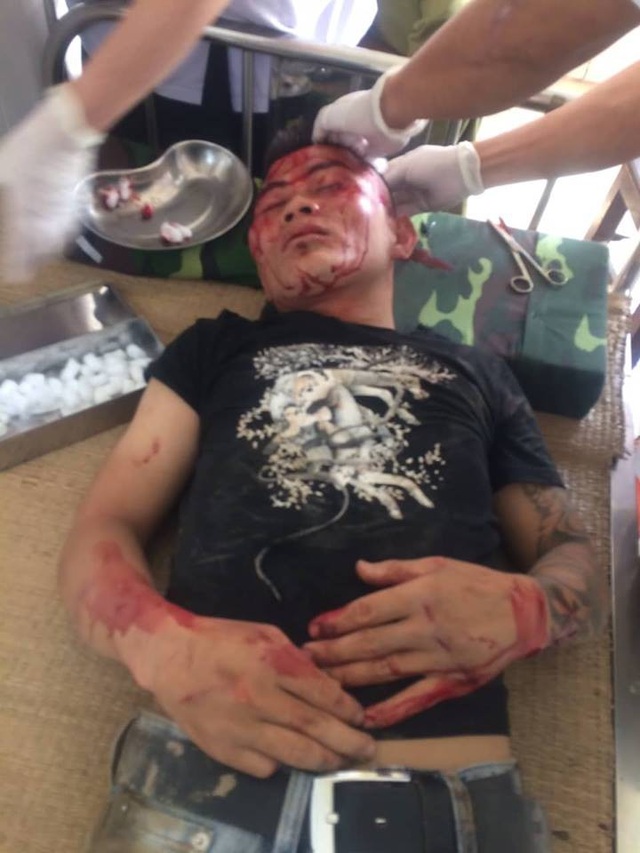 Nghi án bảo kê máy gặt, côn đồ liên tiếp mang hung khí đến hành hung - 3 Đối tượng Lương bị người dân vây đánh.