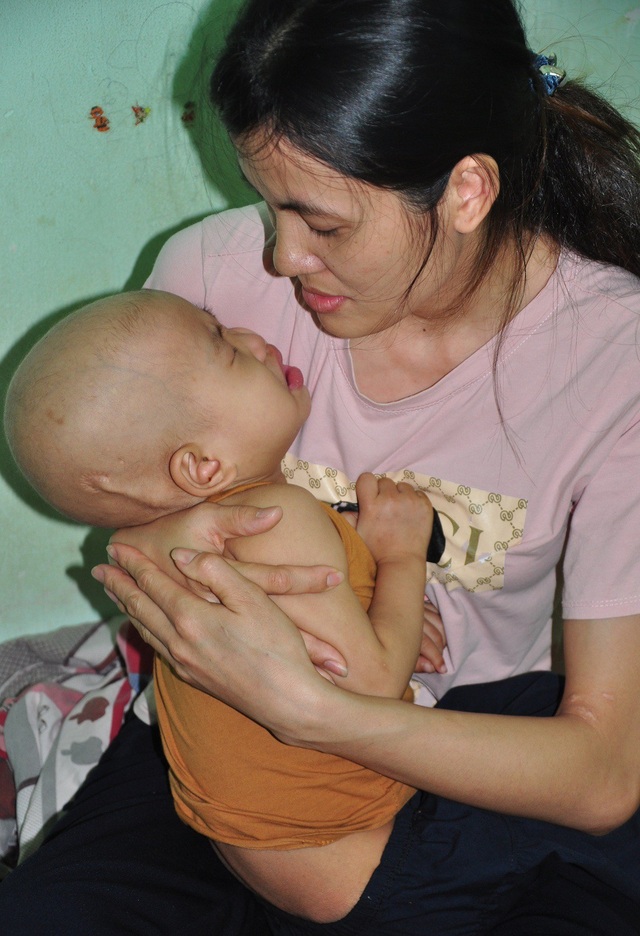 Tiếng khóc xé lòng của bé 3 tuổi bị u não thất - 8 Đã có chỉ định phẫu thuật sỏi mật nhưng Lý còn trở về trong quê để vay tiền.