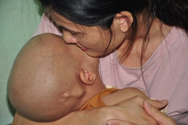 Tiếng khóc xé lòng của bé 3 tuổi bị u não thất - 4 Ôm con vào lòng, Lý cũng không cầm được nước mắt.