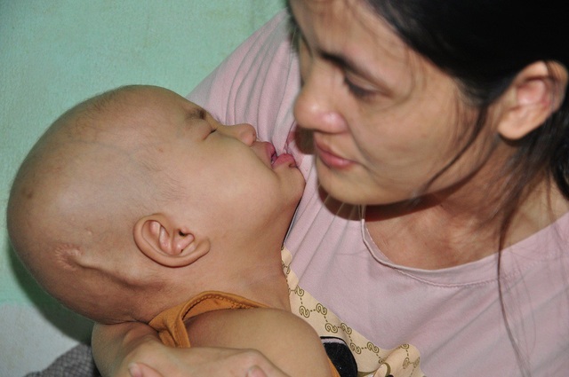 Tiếng khóc xé lòng của bé 3 tuổi bị u não thất - 5 Em sợ hãi một ngày không giữ được con gái bên cạnh mình nữa.